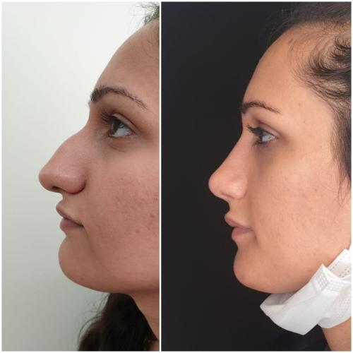 fotos antes y después de nuestros pacientes 1